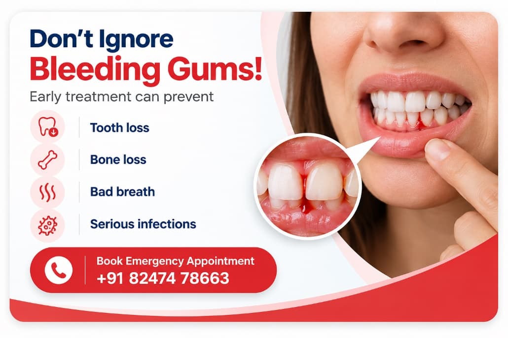 Don't Ignore Bleeding Gums!
