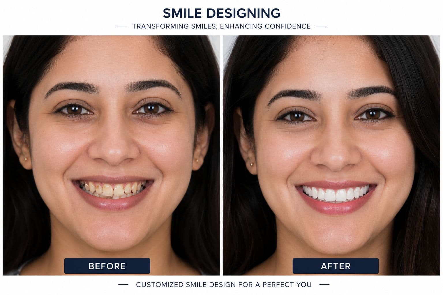 Woman with a beautifully designed smile