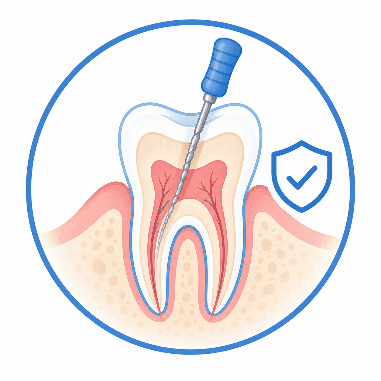 Root canal treatment consultation