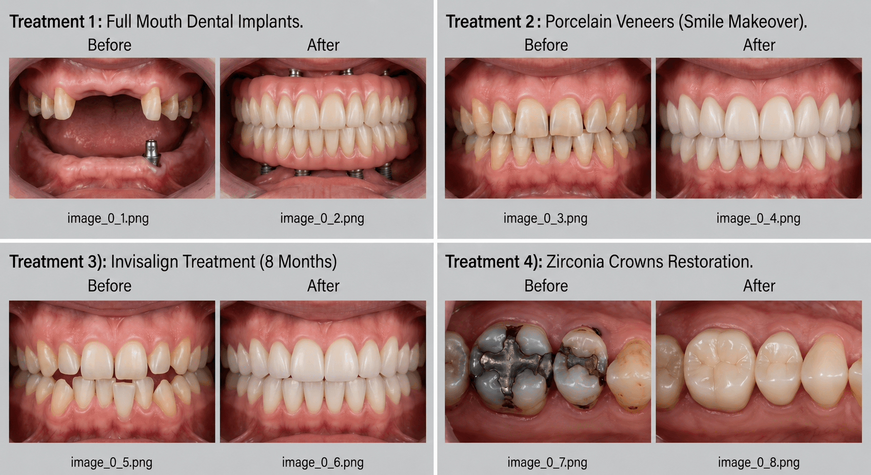 Smile Transformations Overview