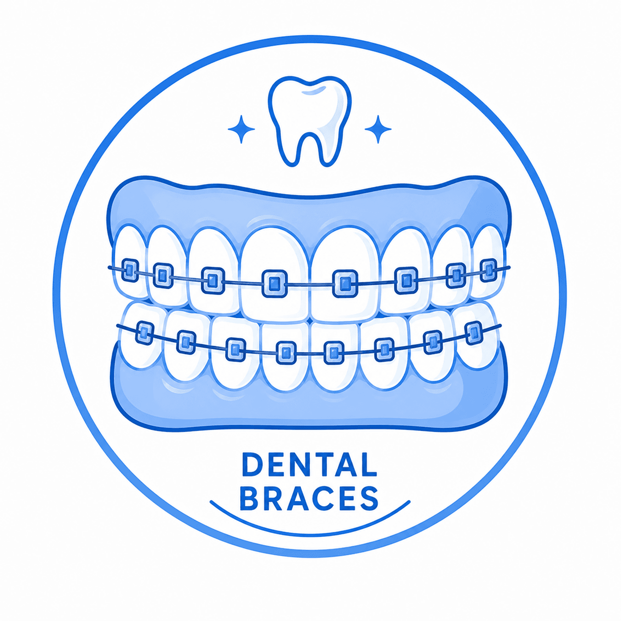 Dental Braces