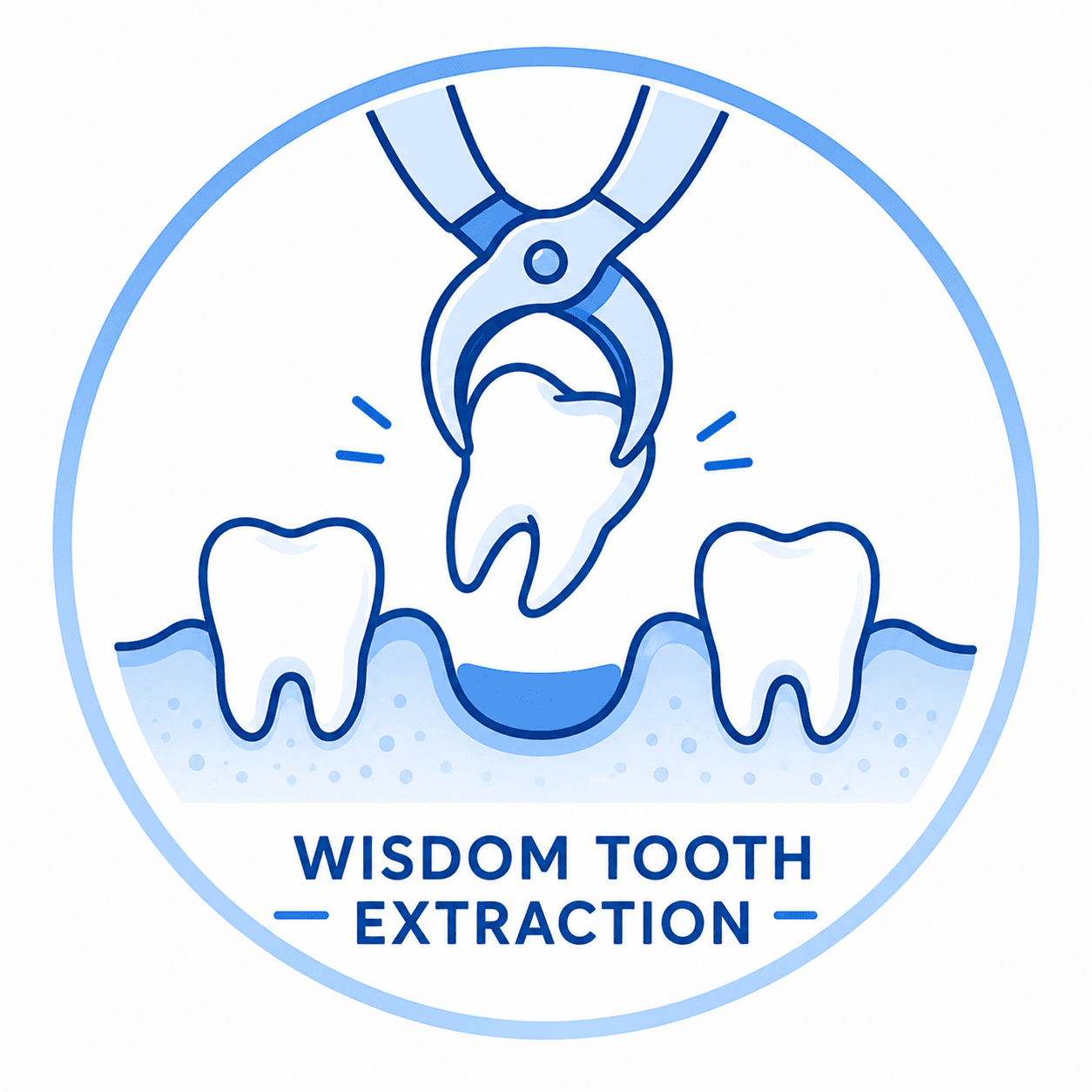 Wisdom tooth 3D illustration
