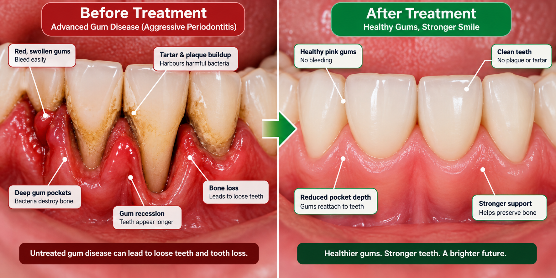 Clinical Results Before and After Showcase